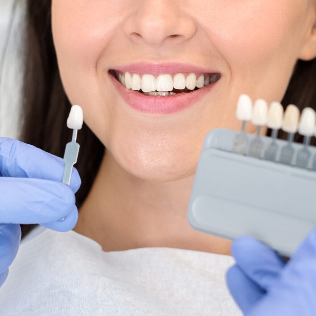 Dentist applying sample from tooth scale to happy patient teeth