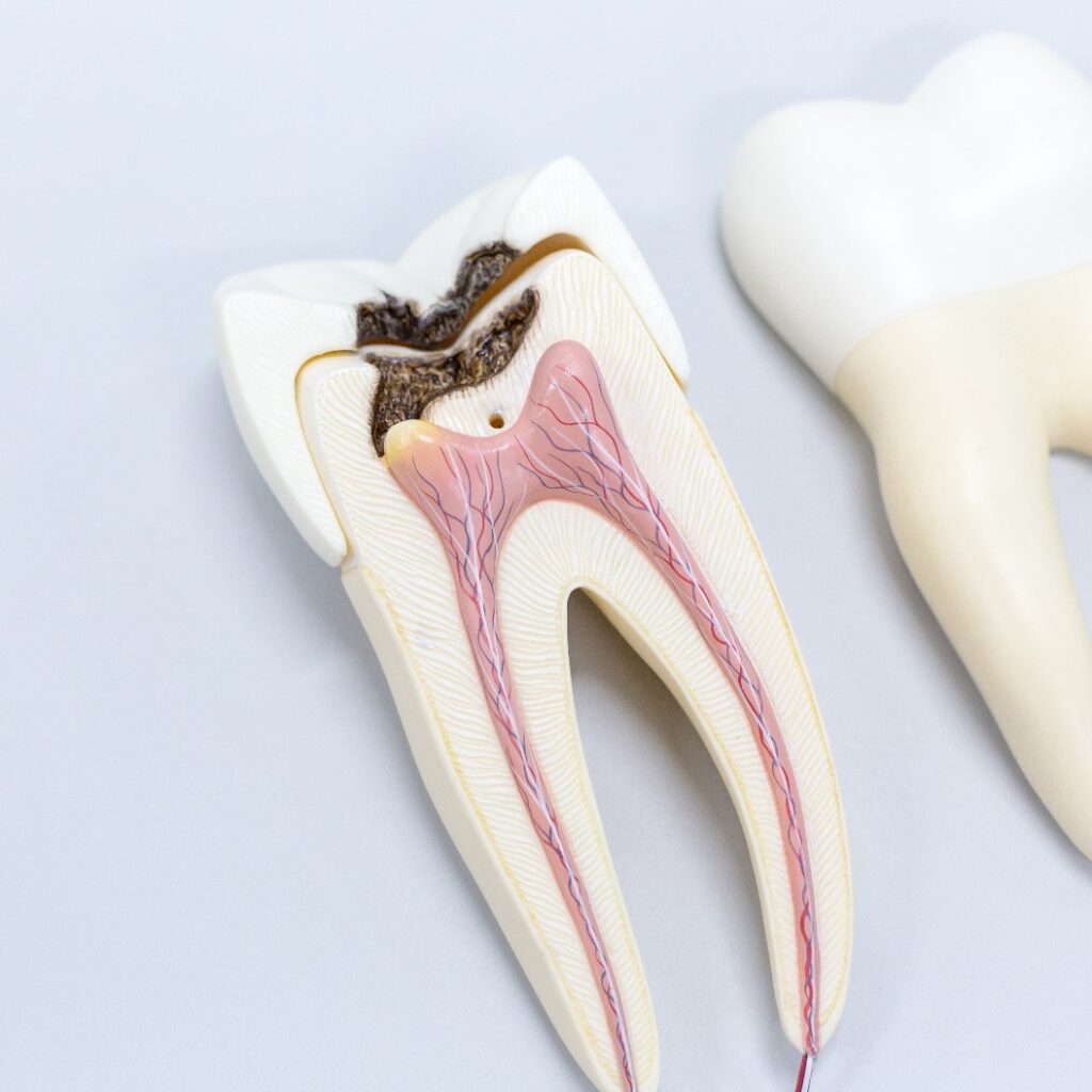 Tooth model for classroom education and in laboratory.